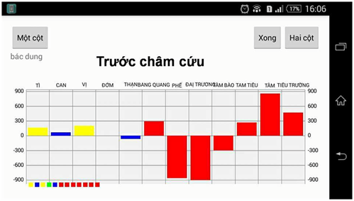 Chứng đau trong xương